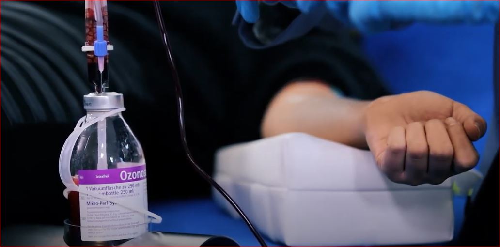 Große Eigenblutbehandlung mit OZONOSAN Vakuumflasche